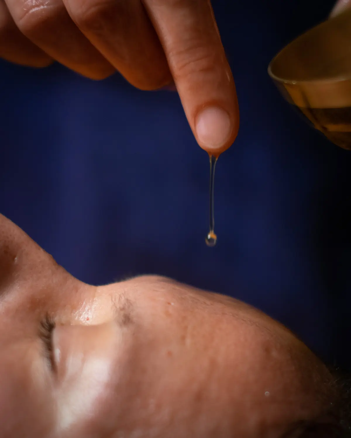 Farbfoto Shirodhara. Von einer Hand rinnt ein Tropfen Öl auf eine Stirn.